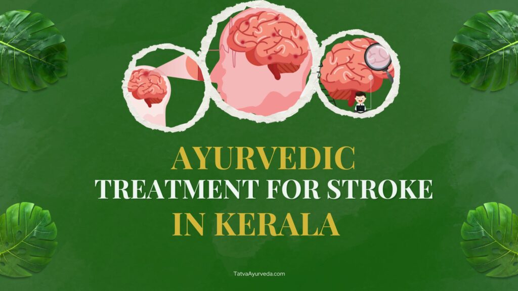 Ayurvedic Treatment for Stroke in Kerala
