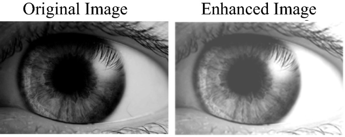 Why Image Enhancement Is So Helpful During COVID