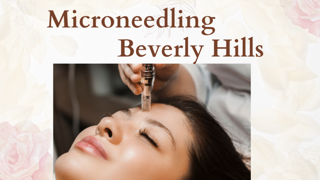 Microneedling Beverly Hills