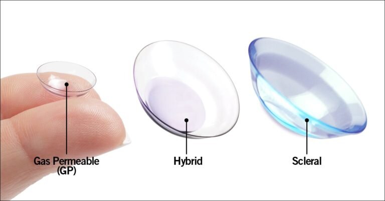 Introduction the actual Experienced Breakthroughs associated with Scleral Lenses: Revolutionizing Attention Treatment as well as Eyesight Static correction