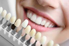 Dental Hygiene Treatment in Dubai: Maintaining a Radiant Smile and Optimal Oral Health