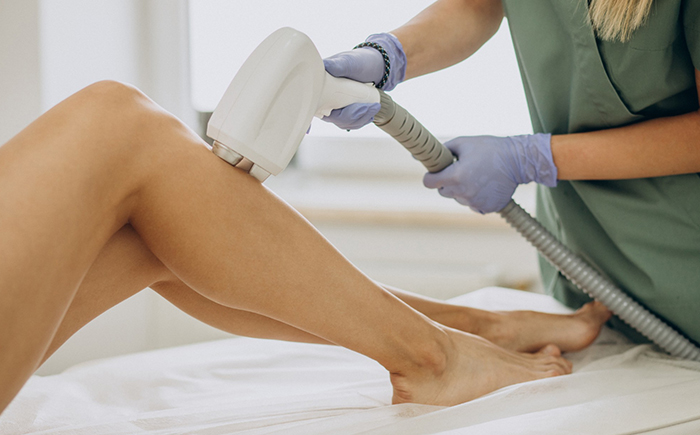 laser hair removal singapore