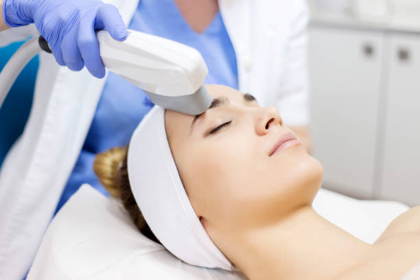 Effortless Pigmentation Mark Removal: Exploring the Benefits of Yellow Laser Treatment