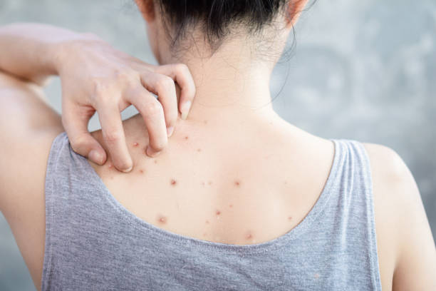 Is a Back Facial in Singapore Worth It for Bacne Issues?