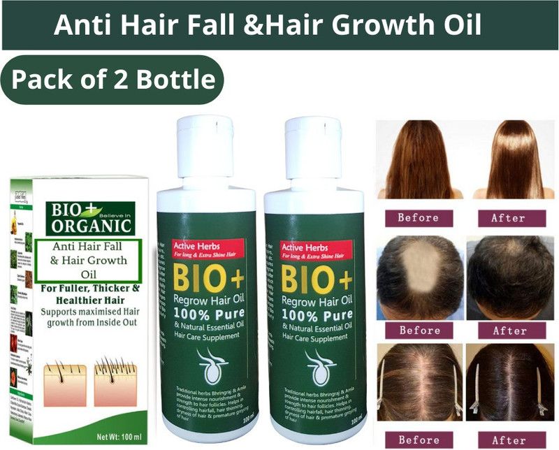 natura herbal Bio Plus Anti Hair Fall -Anti Dandruff & Hair Regrowth Oil For Men & Women Hair Oil  (200 g)