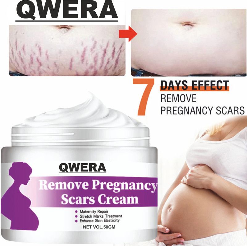 Qwera Stretch Marks Cream for Reducing Stretch Marks & Scars for All Skin Type  (50 g)