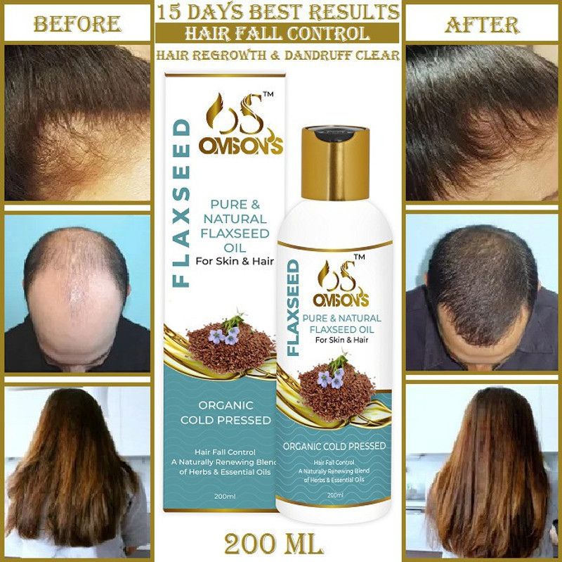 OMSONS Natural Flaxseed Hair Oil  (200 ml)