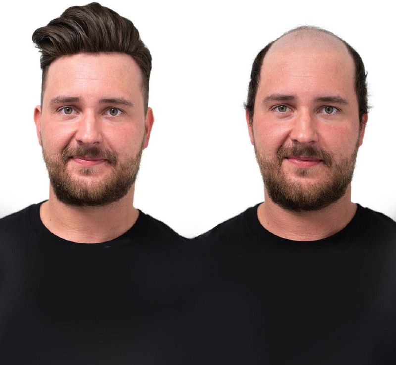HAVEREAM Hair Wig  (Men)