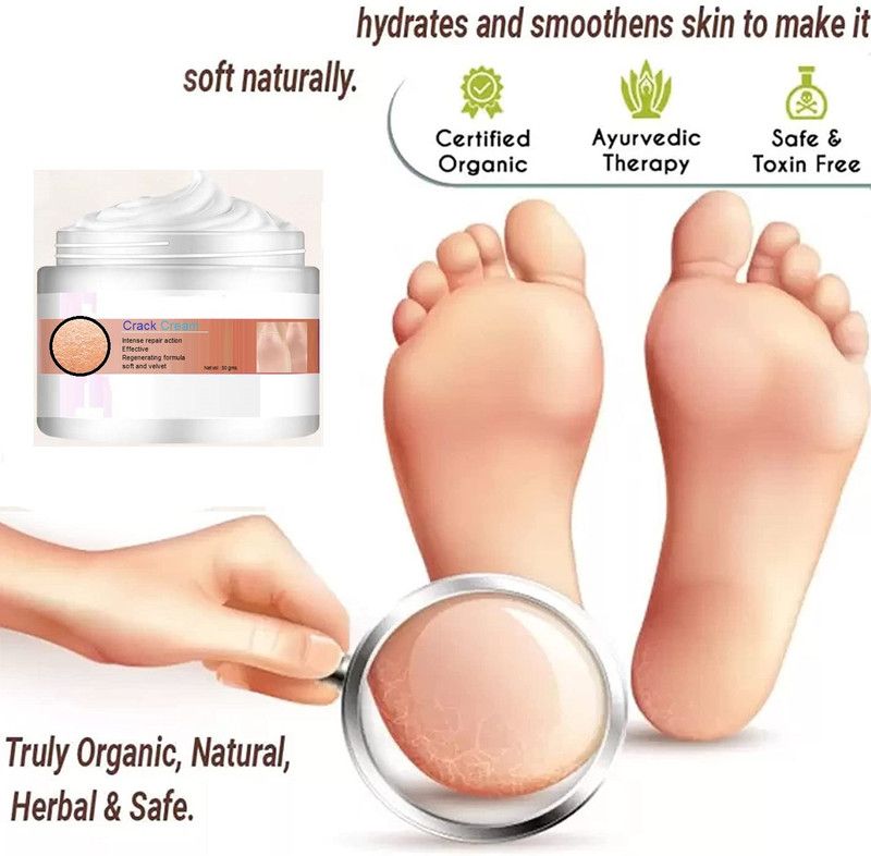 imelda Organic Premium Cracked Heel Repair And Smooth Foot  (50 g)