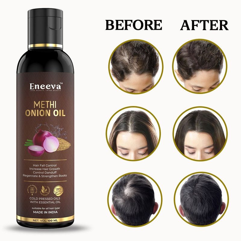 eneeva Eneeva Onion(Methi) Herbal hair oil for Men and Women Hair Oil 100ml Hair Oil  (100 ml)