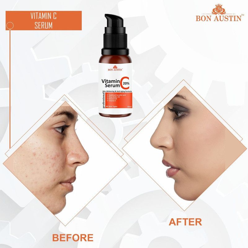 Bon Austin Premium Vitamin C Serum- For Skin Whitening & Skin Brightening(30 ml)  (30 ml)
