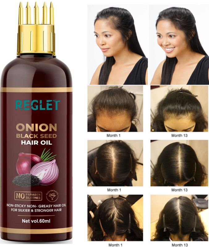 REGLET Premium quality hair oil for hair Regrowth-whith comb applicator- Hair Oil  (60 ml)