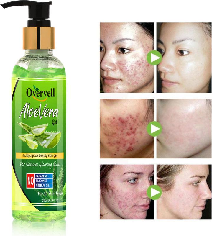 overvell Aloe Vera Gel For Skin Hair No Parabens, No Sulphate, No Alcohol - All Skin & Hair Types With SPF-30 (200 ml)  (200 ml)