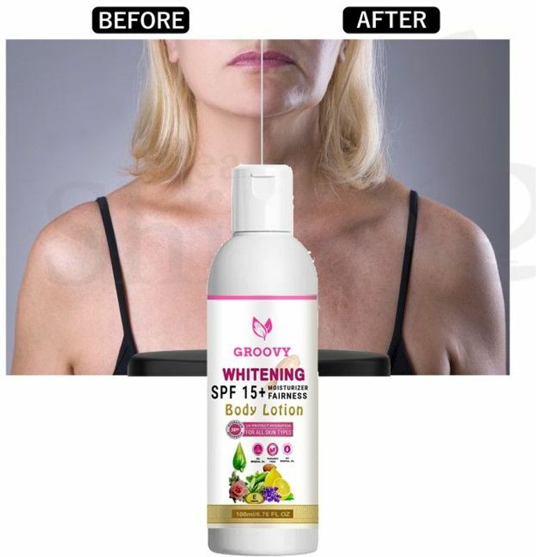 TERIHAR Skin Lighten & Brightening Lotion Pack Of 1 Lotion & Lotions (100 ml)  (100 ml)