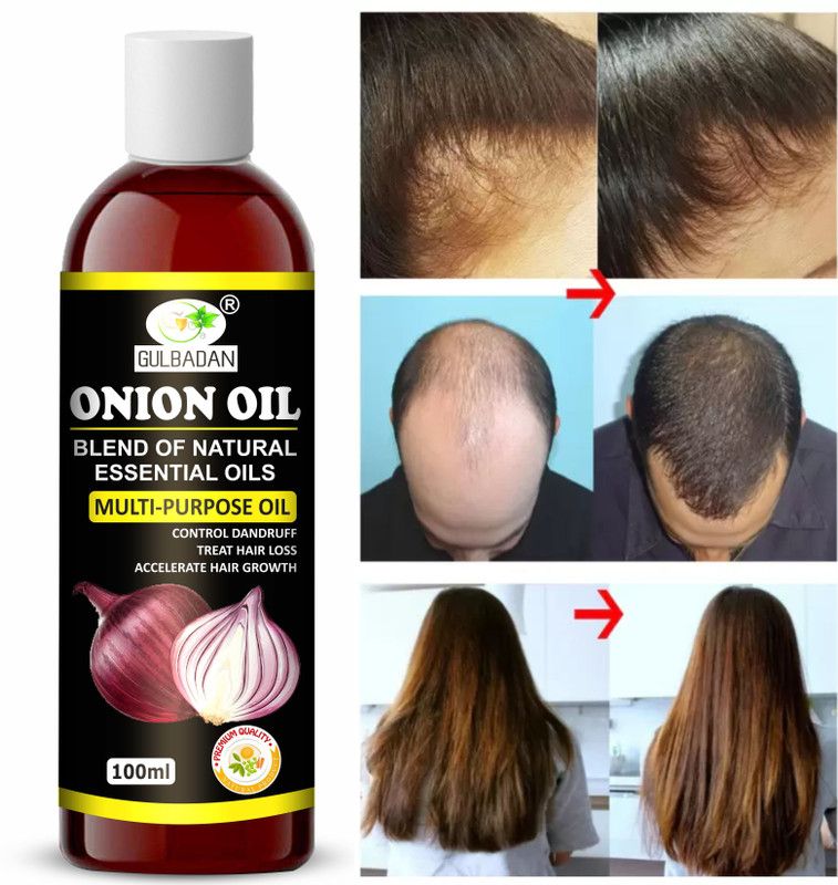 GULBADAN Onion Oil for Hair Regrowth Hair Oil  (100 ml)