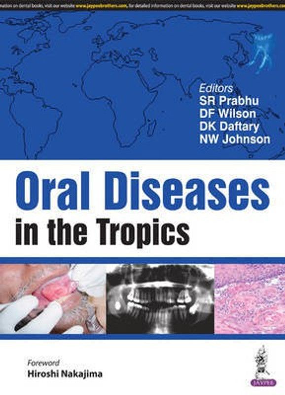Oral Diseases in the Tropics  (English, Paperback, Prabhu S R)