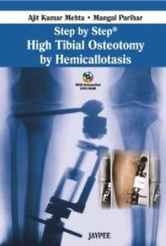 Step by Step: High Tibial Osteotomy by Hemicallotasis  (English, Mixed media product, Mehta Ajit Kumar)