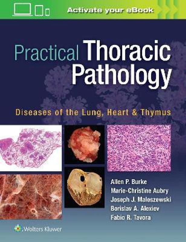 Practical Thoracic Pathology  (English, Hardcover, Burke Allen P.)