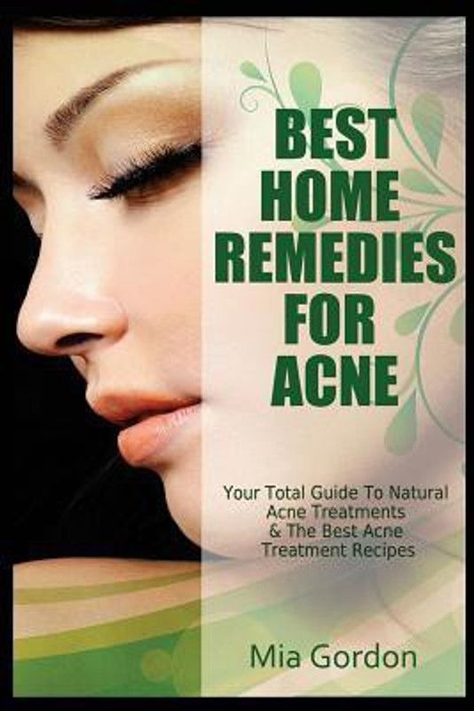 Best Home Remedies for Acne - Your Total Guide to Natural Acne Treatments & the Best Acne Treatment Recipes  (English, B, ENG, A)