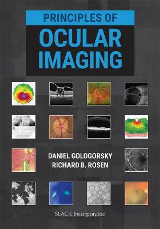 Principles of Ocular Imaging  (English, Hardcover, Gologorsky Daniel)