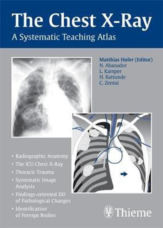 The Chest X-Ray  (English, Paperback, Hofer Matthias)