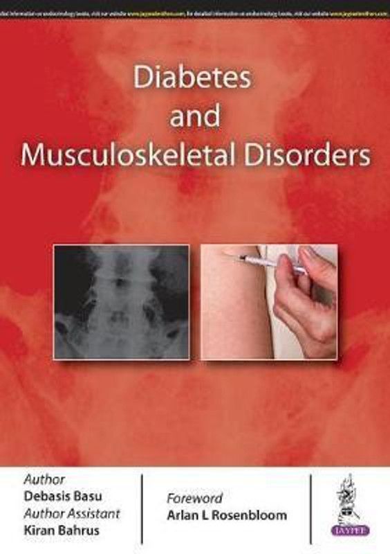 Diabetes and Musculoskeletal Disorders  (English, Paperback, Basu Debasis)