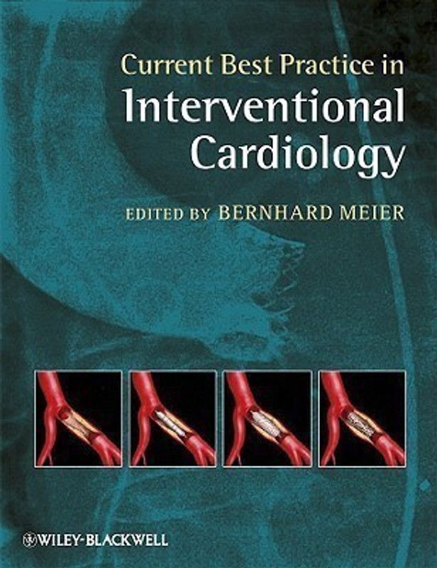 Current Best Practice in Interventional Cardiology  (English, Hardcover, unknown)