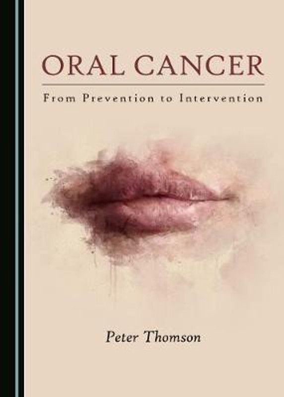 Oral Cancer  (English, Hardcover, Thomson Peter)