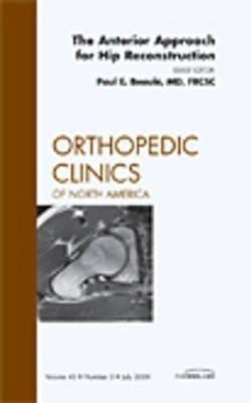 The Anterior Approach for Hip Reconstruction, An Issue of Orthopedic Clinics  (English, Hardcover, Beaule Paul E. MD, FRCSC)