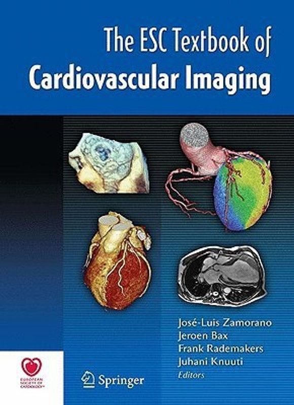 The ESC Textbook of Cardiovascular Imaging  (English, Hardcover, unknown)
