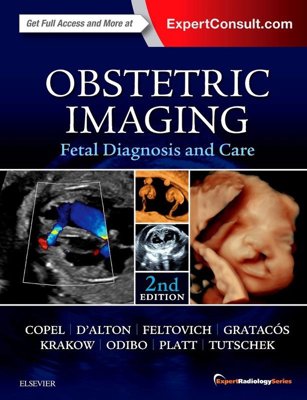 Obstetric Imaging: Fetal Diagnosis and Care  (English, Hardcover, Copel Joshua MD)