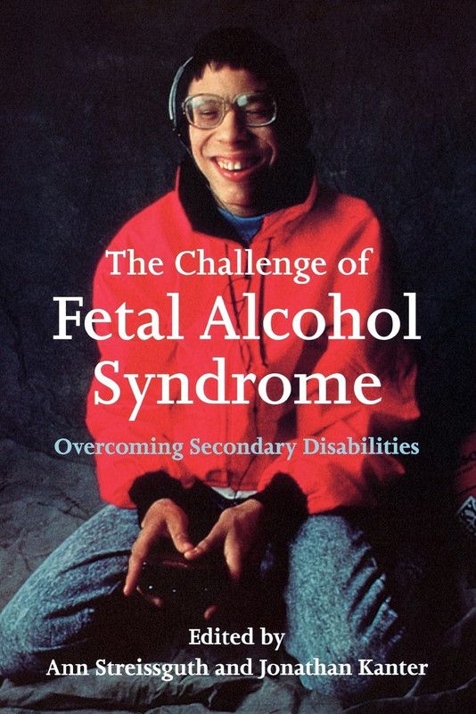 The Challenge of Fetal Alcohol Syndrome  (English, Paperback, unknown)