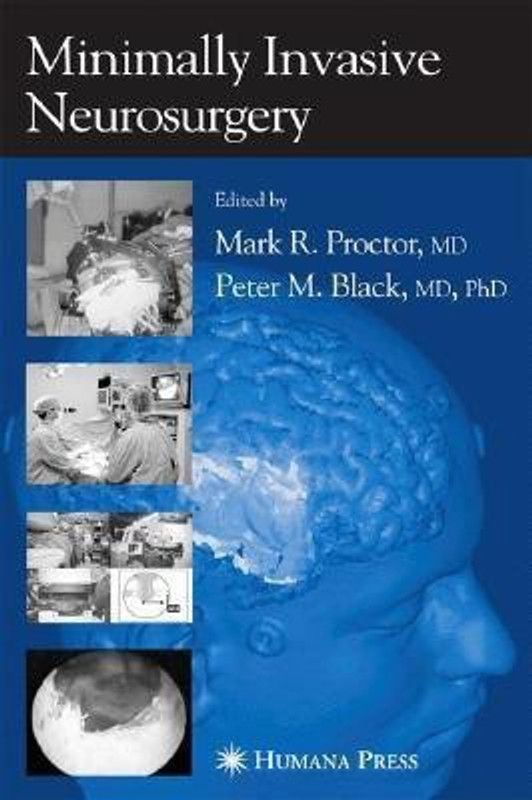 Minimally Invasive Neurosurgery  (English, Hardcover, unknown)