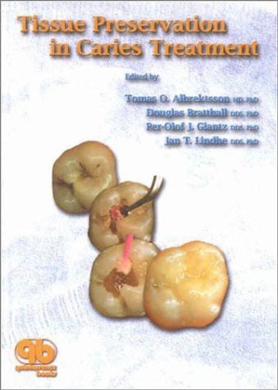 Tissue Preservation in Caries Treatment  (English, Hardcover, Albrektsson Tomas)