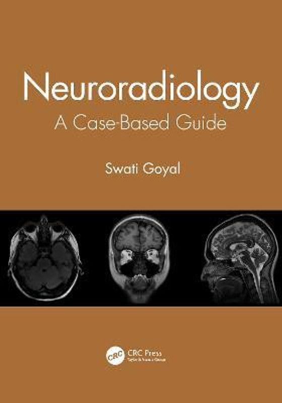 Neuroradiology  (English, Paperback, Goyal Swati)