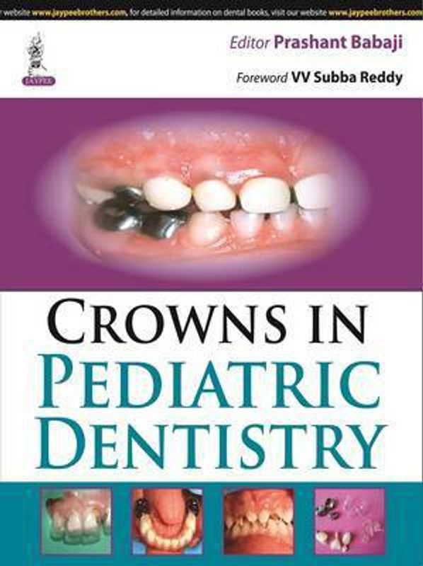 Crowns in Pediatric Dentistry  (English, Paperback, Babaji Prashant)