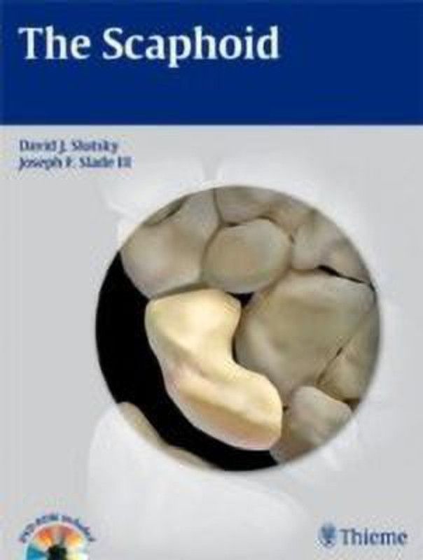 The Scaphoid  (English, Hardcover, unknown)