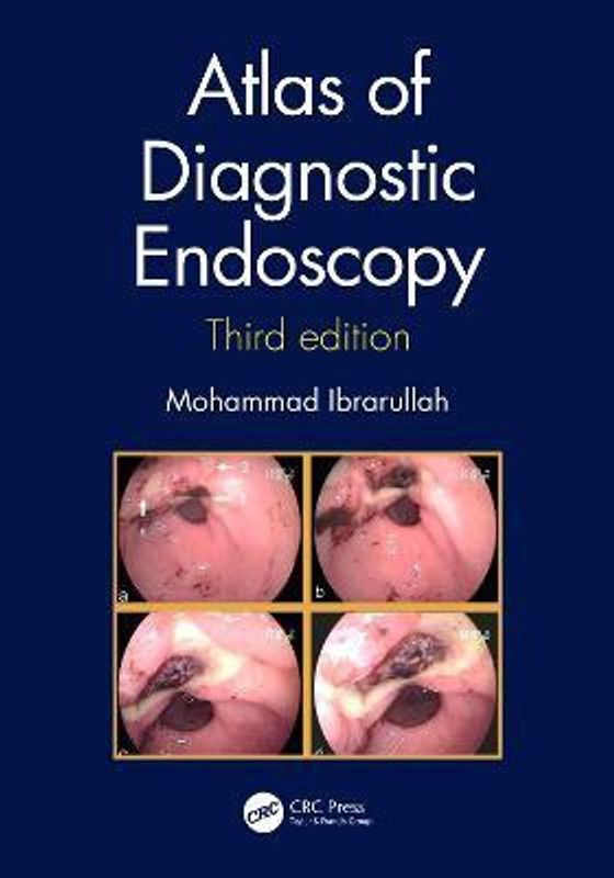 Atlas of Diagnostic Endoscopy, 3E  (English, Hardcover, Ibrarullah Mohammad)