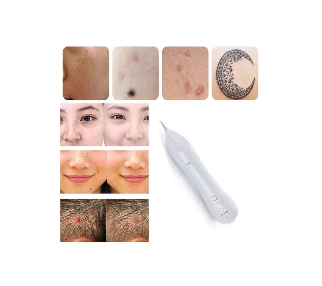 Laser Spot Mole Removal pen Remove Moles at Home Easy and Quick