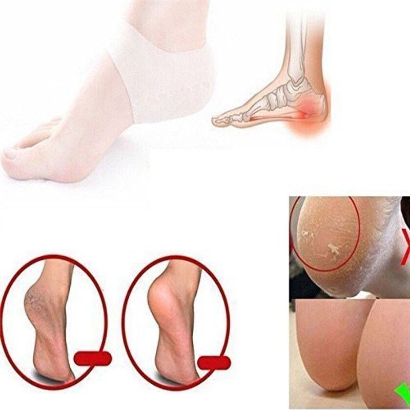 smile4u Maintenance Cracked Foot Skin Care Protectors (WHITE) Heel Support  (Brown)