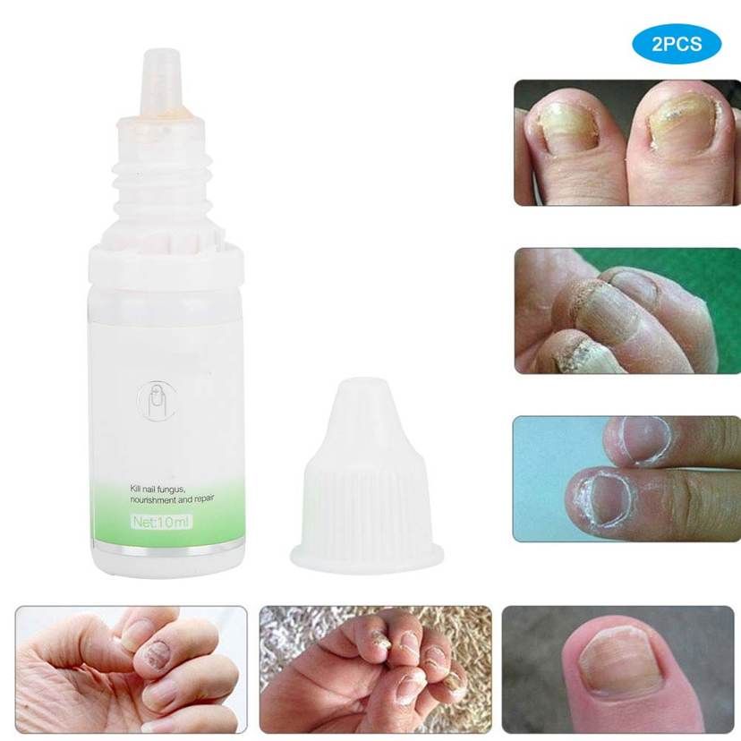2pcs Household Nail Repair Serum Hand Toe Nourishing Moisturizing Oil
