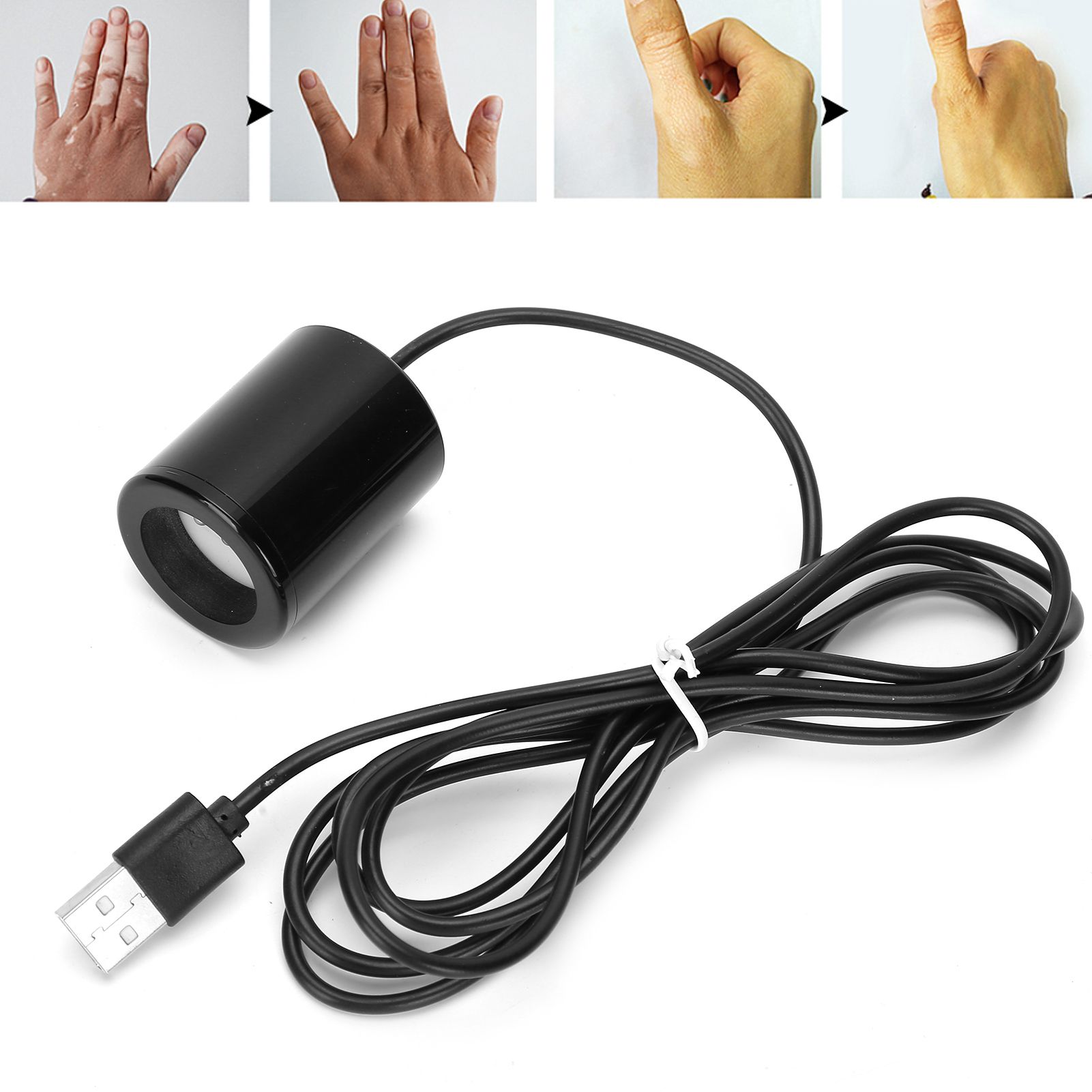 Vitiligo Ultraviolet Physiotherapy Instrument White Spot Treatment