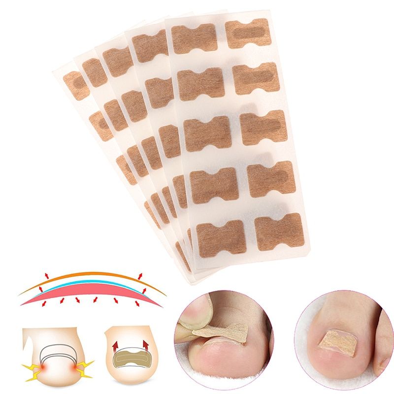 10Pcs/50Pcs Nail Art Ingrown Correction Sticker Foot Care Pedicure Tool Fixer Paronychia Recover Toenail Elastic Patch Corrector