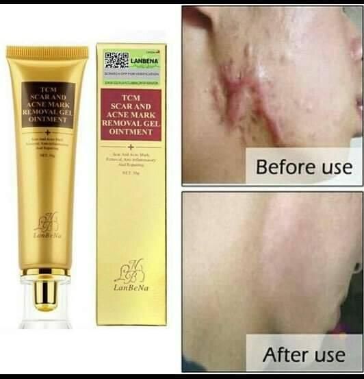 LanBeNa - TCM SCAR OINTMENT (30g) Scar Cream