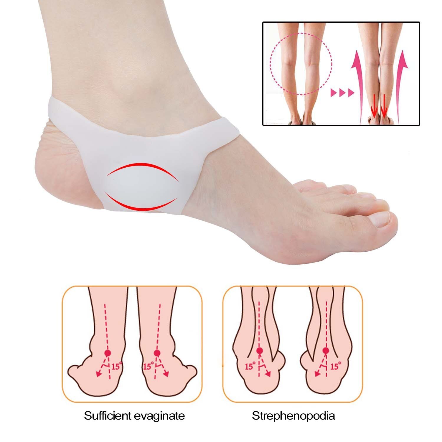 2pcs O-type Foot Corrector Insoles Pads No Slip Shoes For Men And Women Silicone Orthopedic Insoles Arch Pain Relief New