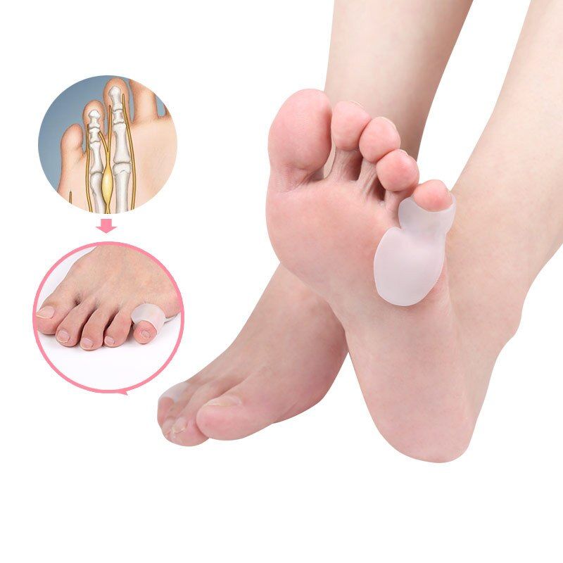 2pieces=1pair New Hot S_ale Small Toe Varus Separator Bunion Overlapping Corrector Silicone Pad Thumb Valgus Straighten Orthosis