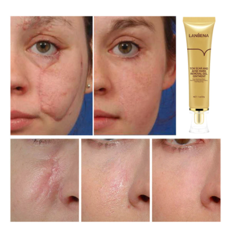 LANBENA Skin Scar Remove Kit 3Pcs/Set - [Combo]