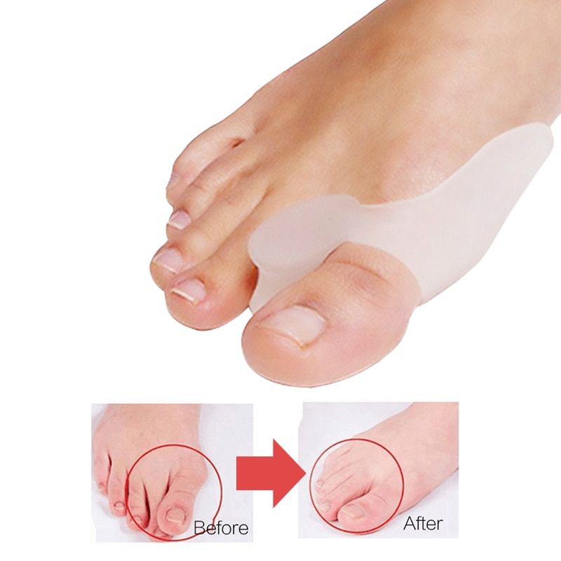 2Pcs Special Hallux Valgus Pro Protector Bone Thumb Orthotics Braces Corrector Soft Silicone Foot Big Toe Separator Pedicure