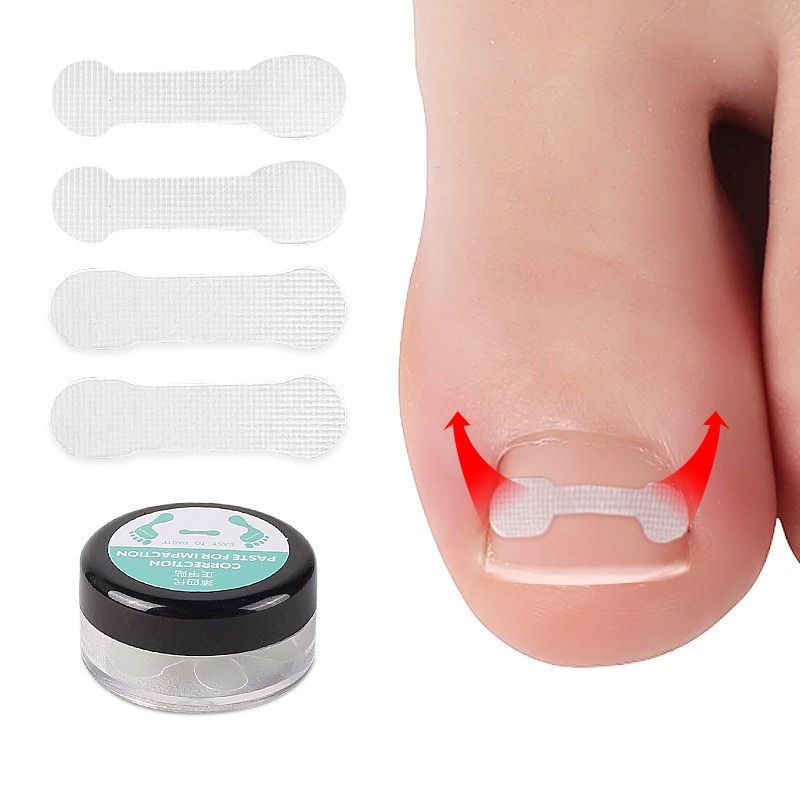 10pcs Ingrown Toe Nail Treatment Ingrown Toenail Correction Tool Elastic Patch Sticker Straightening Clip Brace Pedicure Tools