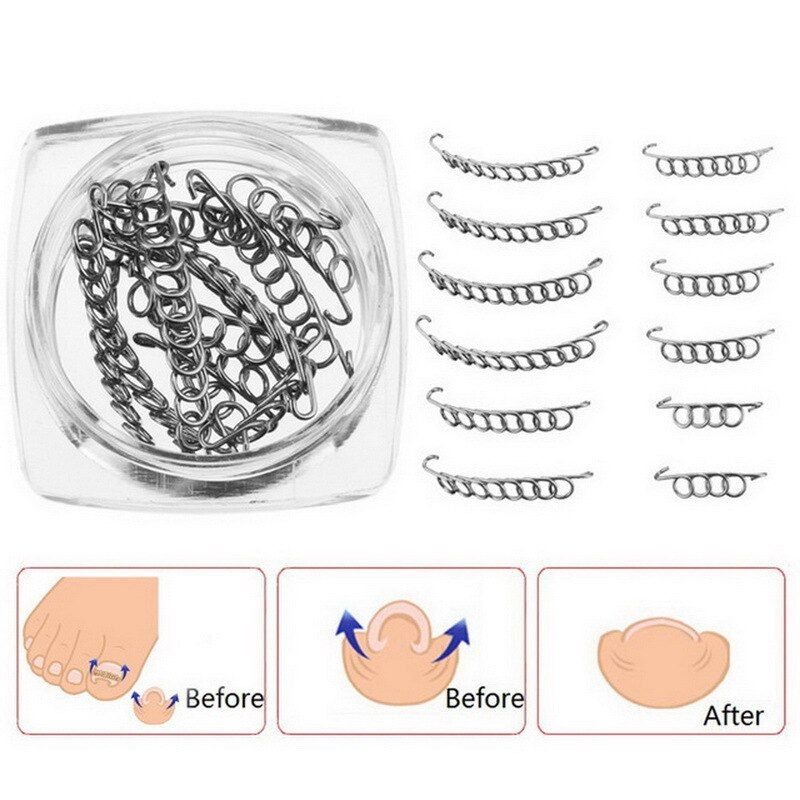 1box Toe Nail Correction Nail Art Ingrown Toenails Paronychia File Patch Wire Remover Care Relief Pain Foot Pedicure Tool
